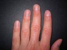 Para blanquear las uñas