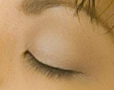 Remedios caseros para los párpados hinchados