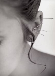 Puntos de auriculoterapia